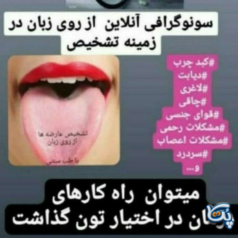 طب سنتی،مزاج شناسی زبان شناسی